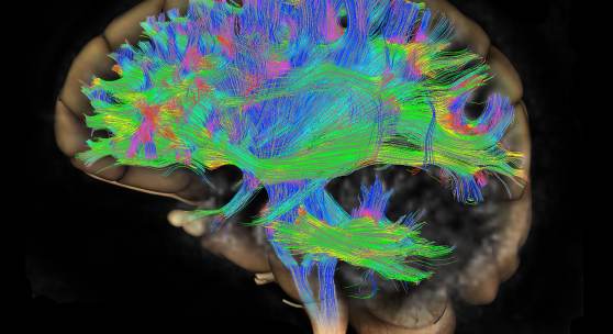 Faser Traktographie Bild des menschlichen Gehirns © Scott Camazine / Alamy Stock Foto.