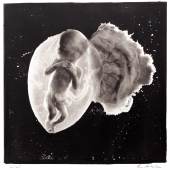 LENNART NILSSON (1922–2017) Foetus 18 weeks, 1965 Ikonenhafte Fotografie als Platinum Print (44,2 x 44,5 cm) Startpreis: 4.000 € / Schätzpreis: 7.000–9.000 €